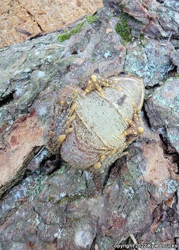 American Toad (Anaxyrus americanus)