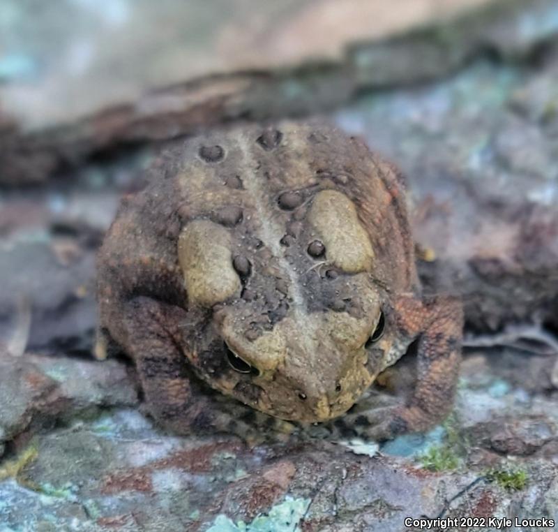 American Toad (Anaxyrus americanus)